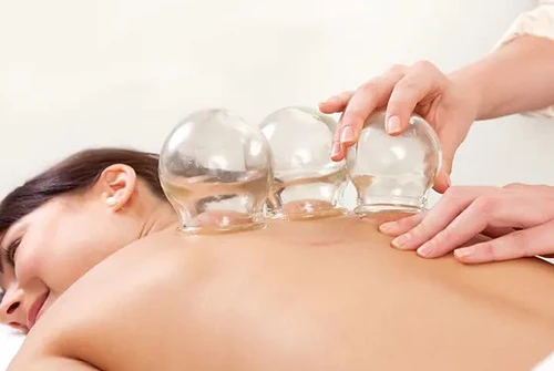 Cupping & GuaSha